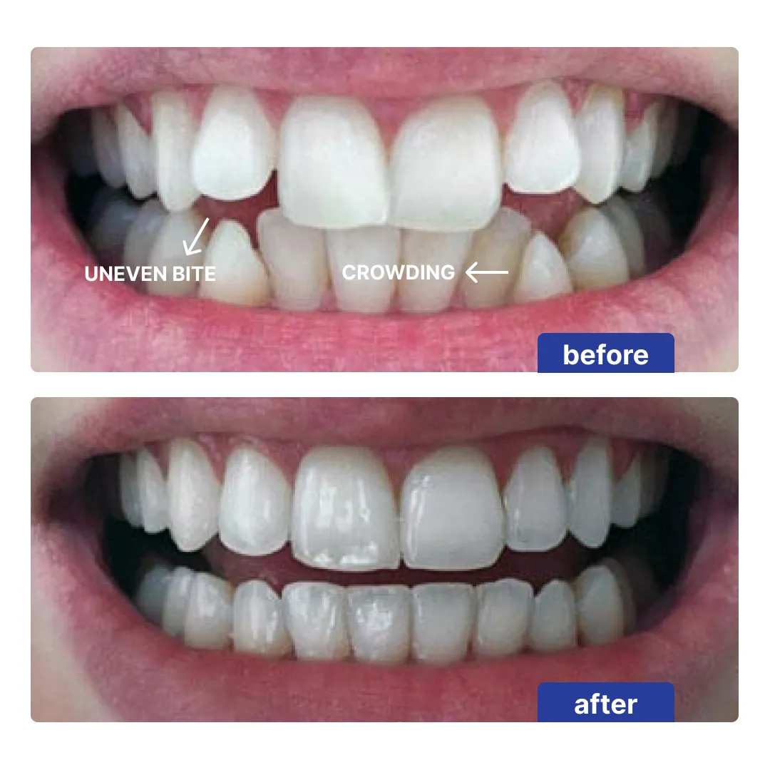 Patient result 1
